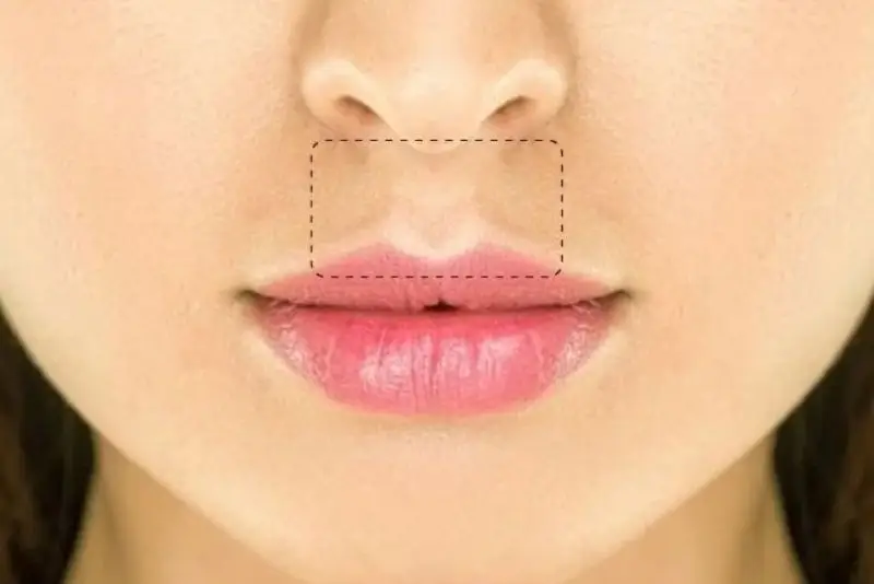 Nhân trung sâu và rộng thể hiện tính cách hiền lành