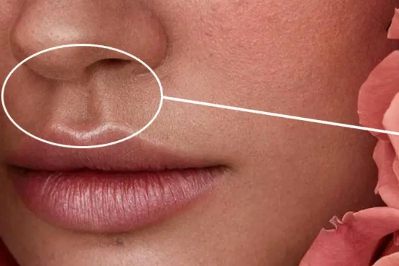 Đường nhân trung nhô cao là người có sức khỏe tốt