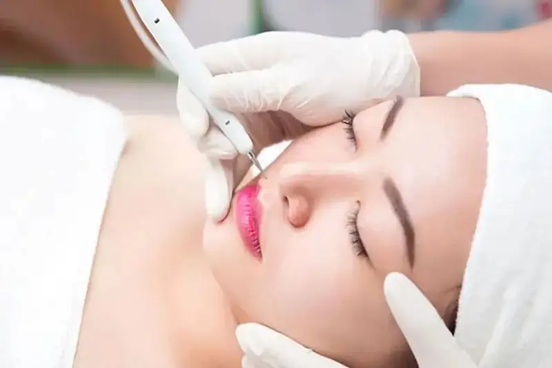 Ứng dụng tia laser để làm rụng nốt mụn thịt