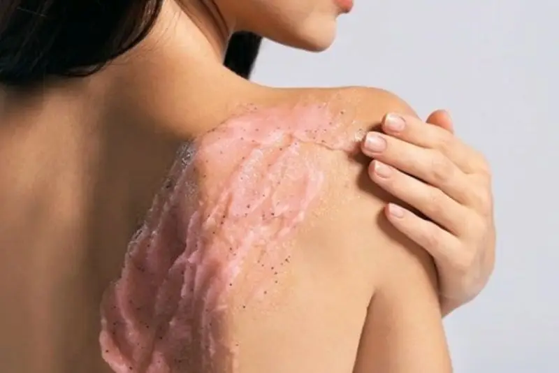 Tẩy tế bào chết định kỳ giúp da thông thoáng và hỗ trợ làm sáng vết thâm