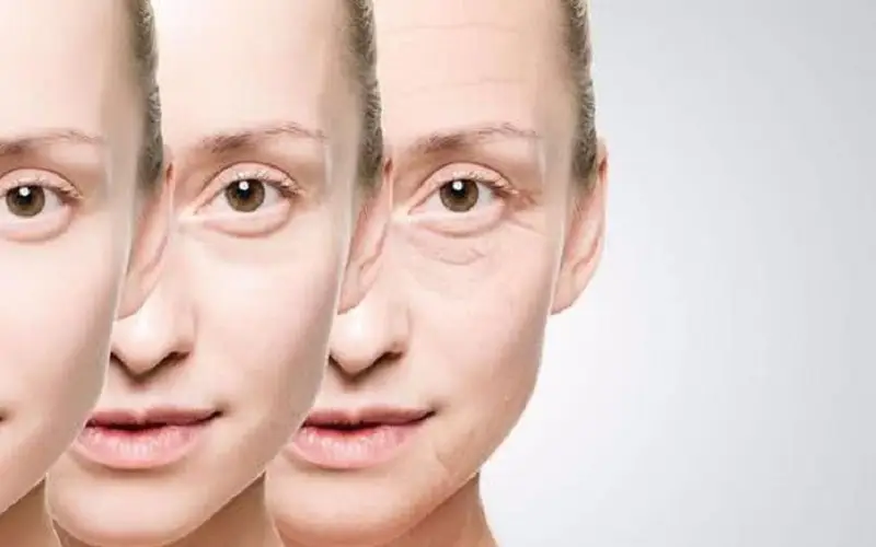 Da vùng mắt bị tác động gây hình thành nếp nhăn, bọng mắt
