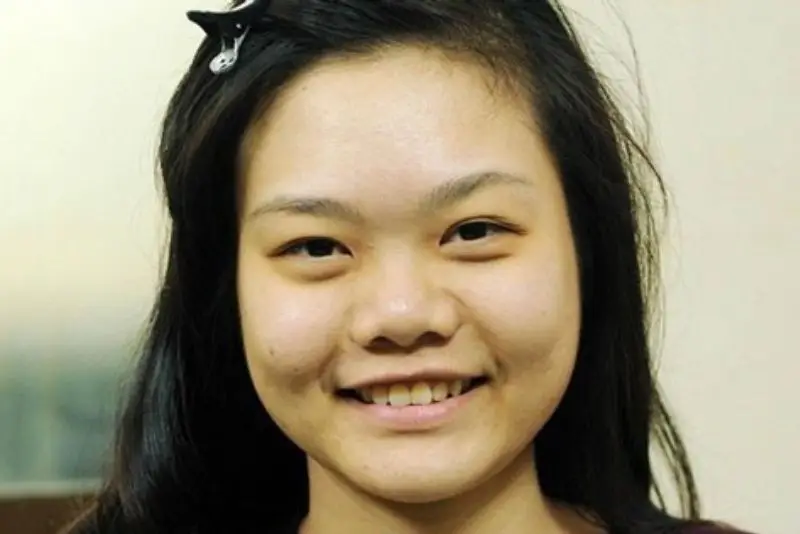 Mũi củ đầy đặn, da mũi dày và phần cánh mũi nở rộng