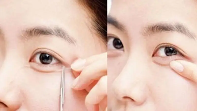 Dùng keo silicon chuyên dụng giúp làm bọng mắt nhanh