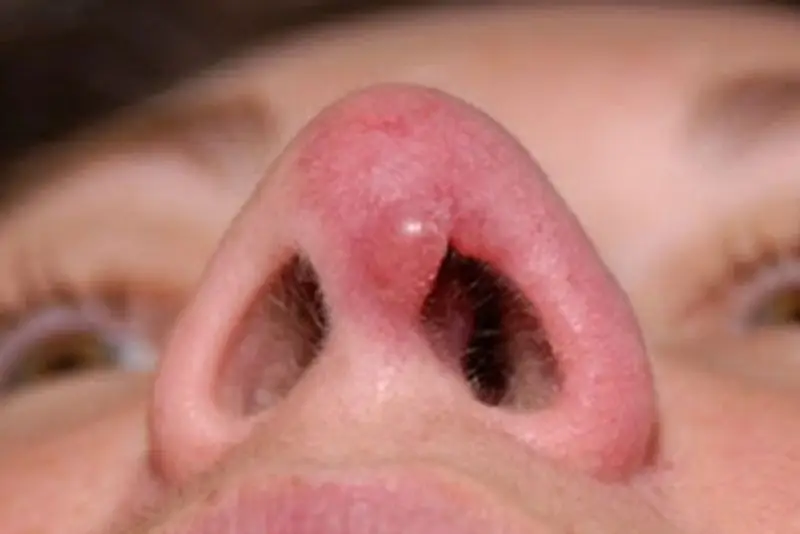 Nếu có dấu hiệu đau, sưng bất thường sau khi tập