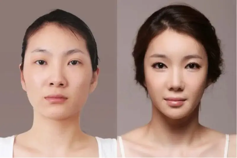 Phương pháp không phẫu thuật, ít xâm lấn, hồi phục nhanh chóng