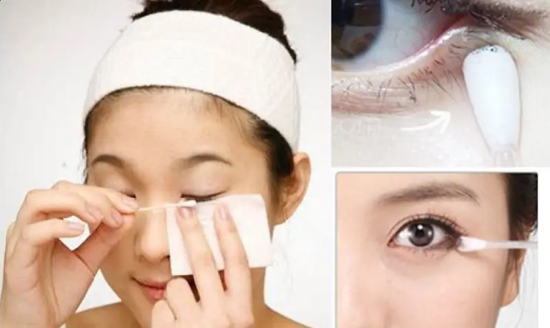 Vệ sinh và bôi thuốc đúng cách