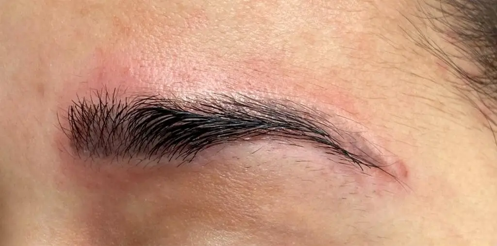 Không nên tác động mày hoặc bóc vảy chân mày