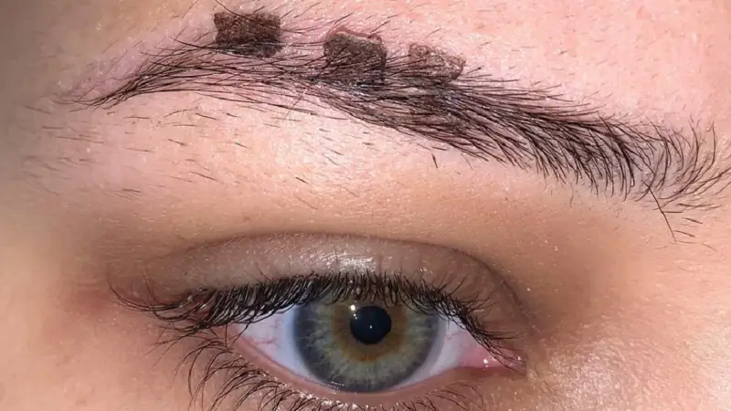 Vảy bong tự nhiên sau điêu khắc vài ngày