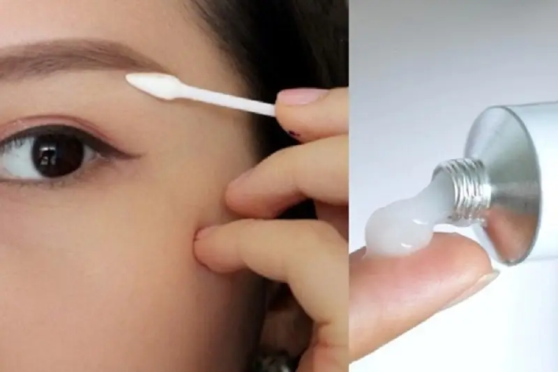 Nên bôi thuốc mỡ khi lông mày bắt đầu lên vảy