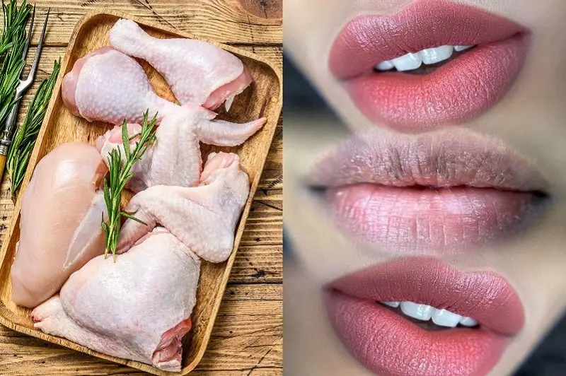 Thịt gà gây ngứa ngáy vết thương vùng môi