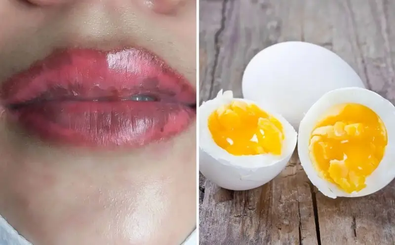 Cần kiêng ăn uống đúng cách sau phun xăm môi