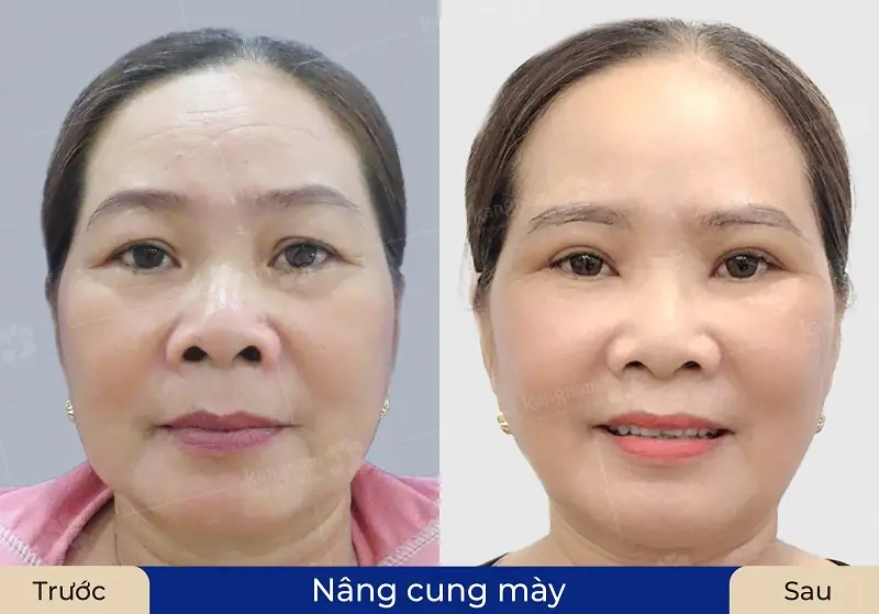 Khách hàng sở hữu chân mày cân đối và hài hòa