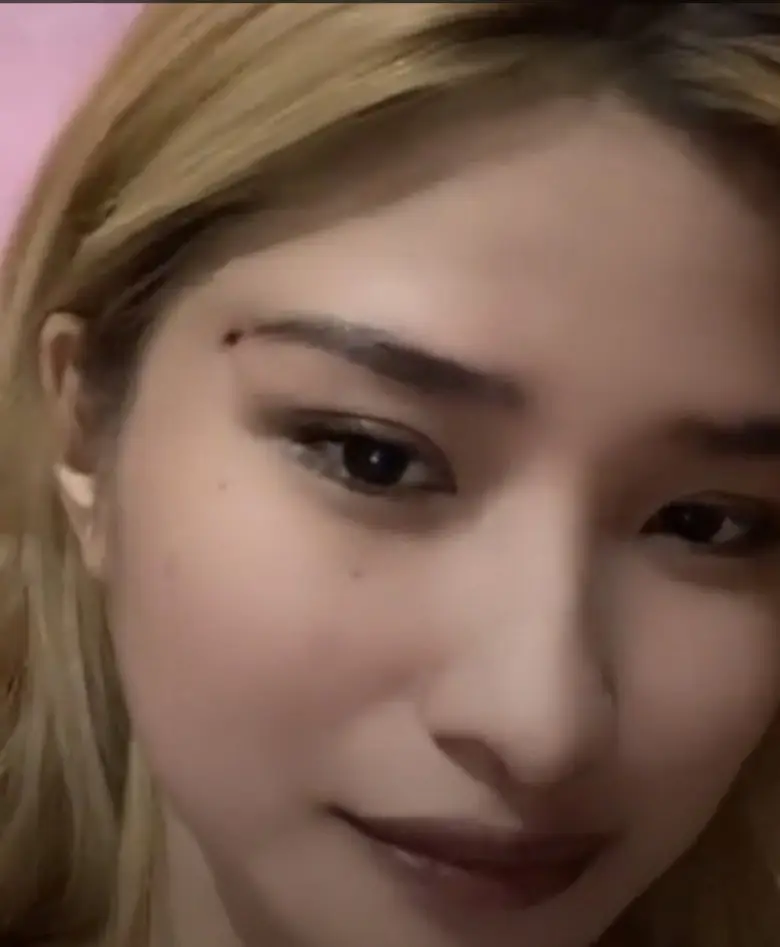 Nên lựa chọn địa chỉ thẩm mỹ uy tín để được tư vấn dáng mí phù hợp