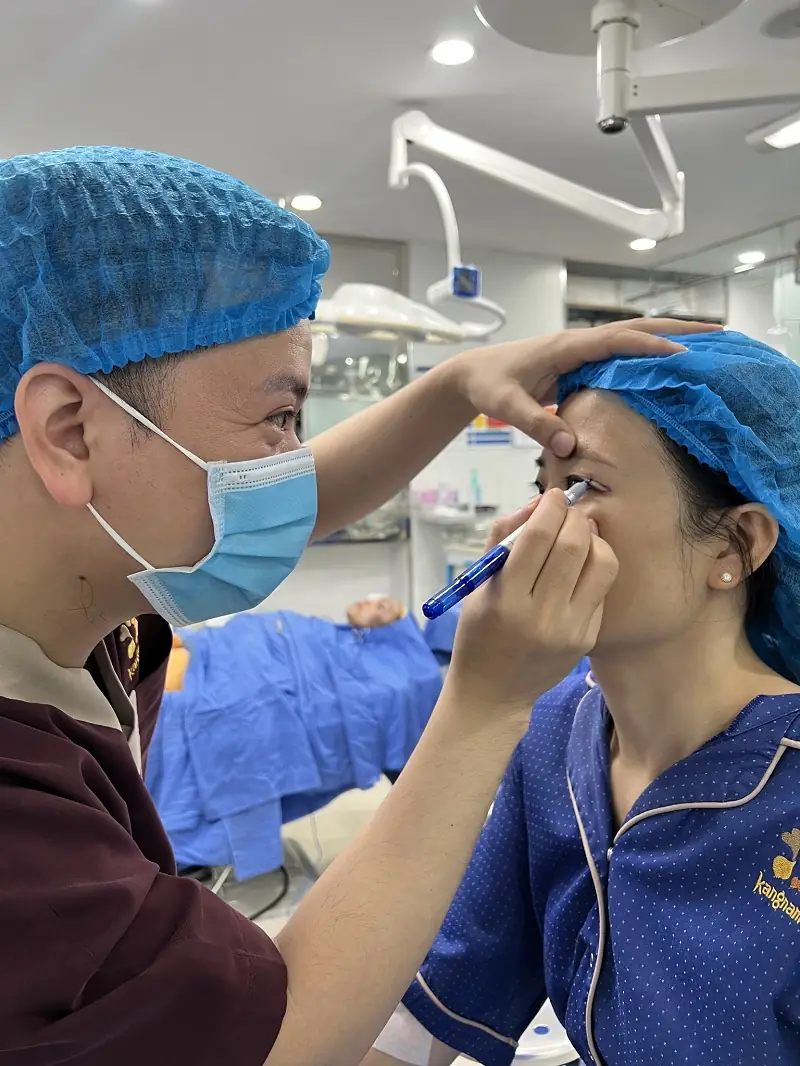 Bác sĩ thăm khám và đánh dấu vùng mí cần sửa