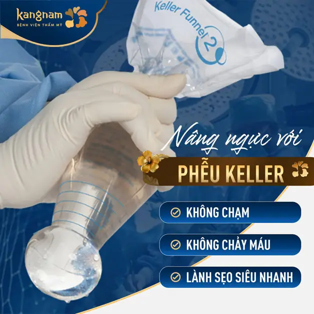 Ứng dụng phễu Keller giảm ma sát khi đặt túi ngực