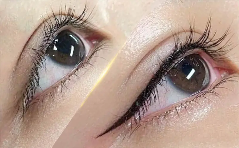 Mí mắt cân đối, sắc nét sau khi thực hiện