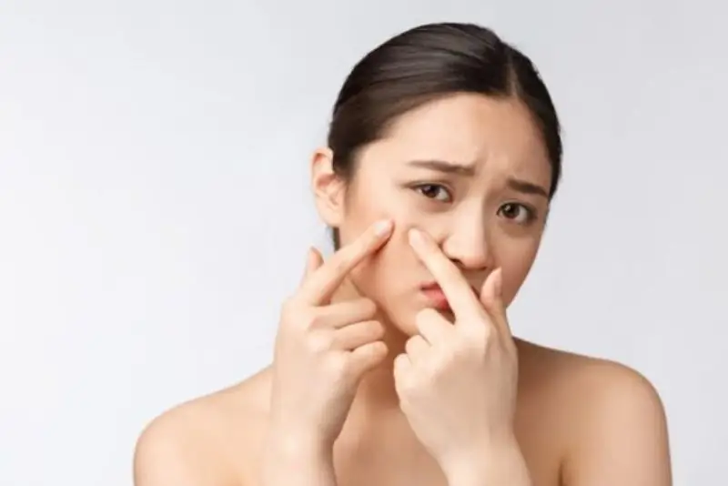 Có nhiều nguyên nhân dẫn đến tiêm filler nổi mụn