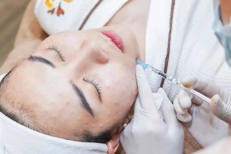 Sau khi tiêm meso cần chăm sóc da cẩn thận