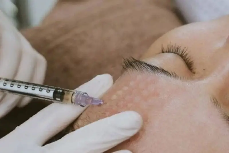 Đặc điểm làn da ban đầu quyết định khả năng duy trì kết quả