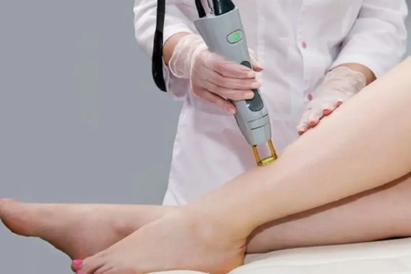 Điều trị thâm mụn bằng laser là phương pháp an toàn và hiệu quả