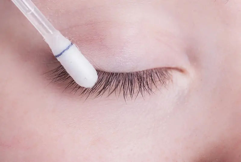 Sử dụng tăm bông thấm nước muối sinh lý để làm sạch mí mắt