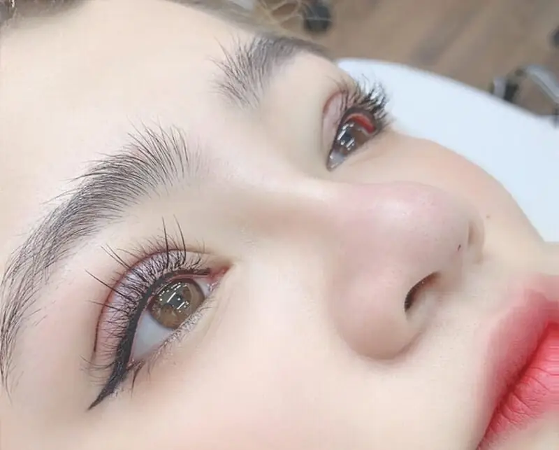 Cắt mí full deep tạo đường rạch dài ở cung mí mắt