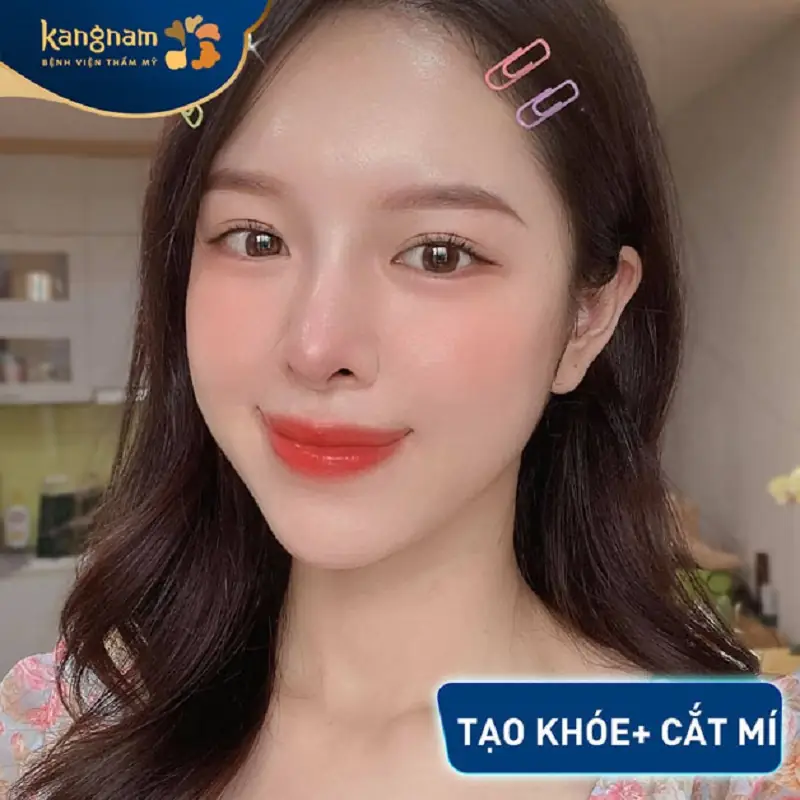 Sau tiểu phẫu đôi mắt cân đối, rõ nét hơn