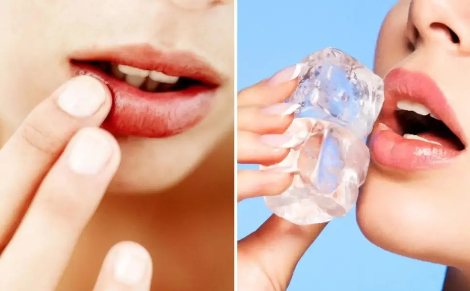 Chườm mát giúp giảm sưng sau phun môi