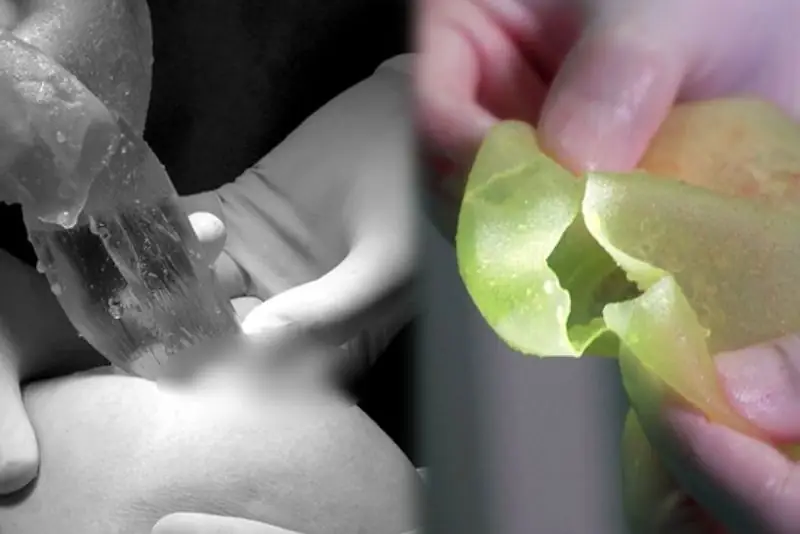 Quy trình nâng ngực bằng túi nước biển