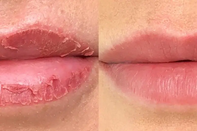 Dặm môi quá sớm khiến màu khó lên chuẩn