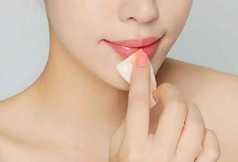 Cần vệ sinh môi sạch sẽ hàng ngày bằng nước muối