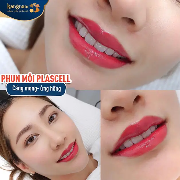 Công nghệ phun môi hiện đại giúp duy trì màu môi lâu dài