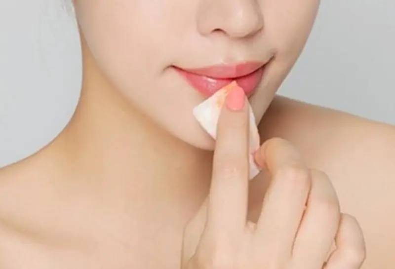 Khách hàng nên vệ sinh môi sạch sẽ bằng nước muối sinh lý