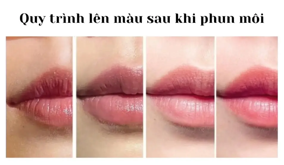 Để môi lành sau vài ngày mới nên dưỡng môi