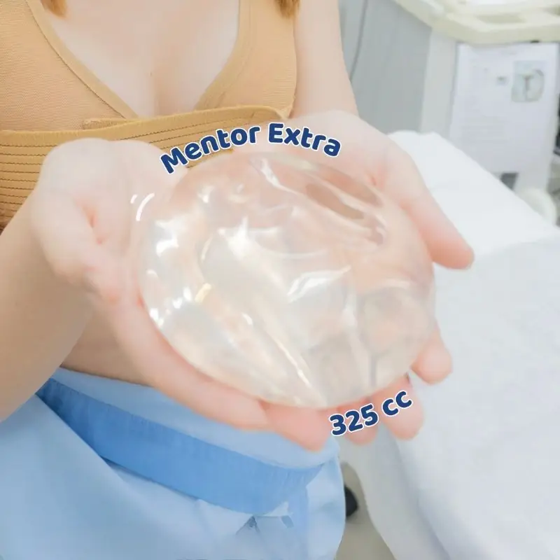 Kangnam sử dụng túi ngực Mentor cao cấp