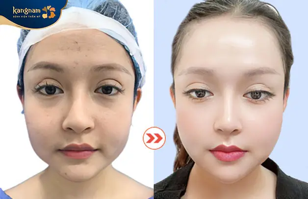 Nên chọn địa chỉ có phản hồi thực tế và hình ảnh trước sau rõ nét của khách hàng