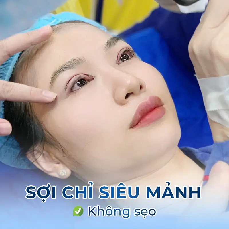 Kangnam sử dụng sợi chỉ siêu mảnh, không để lại sẹo
