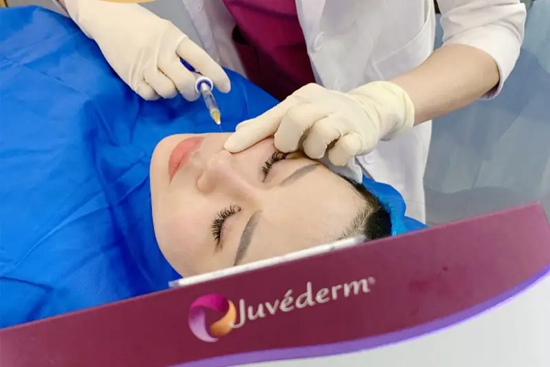 Sau khi tiêm filler cần kiêng nước thời gian đầu