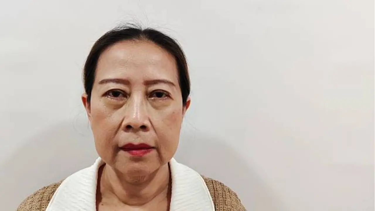 Hình ảnh nâng mũi khi về già, Cánh mũi có thể nở rộng nhẹ do sự thay đổi mô mỡ quanh vùng mặt