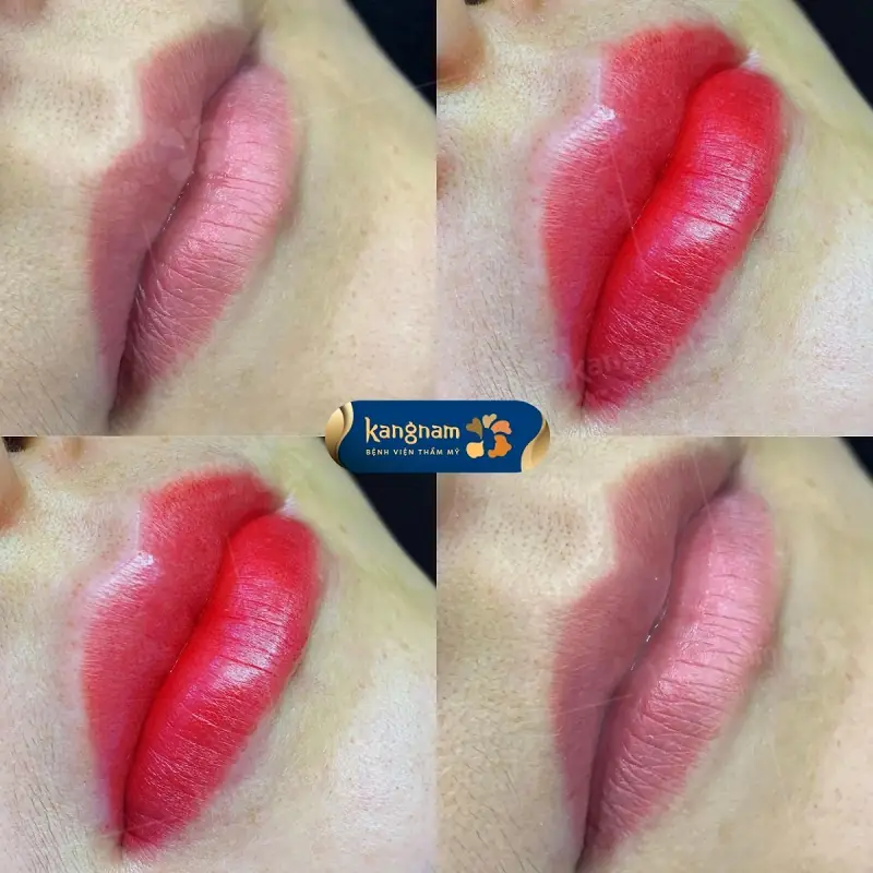 Phun môi Plascell giúp môi lên màu chuẩn đẹp, tự nhiên