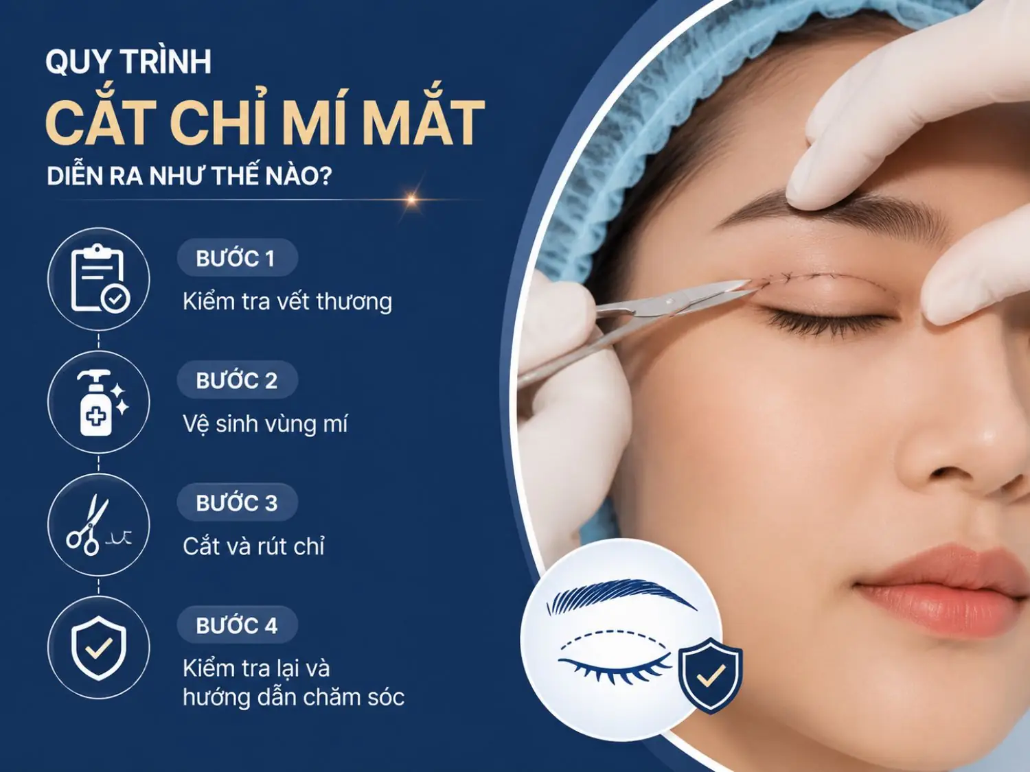 Quy trình cắt chỉ mí mắt thường diễn ra nhanh chóng và nhẹ nhàng, bao gồm kiểm tra tình trạng hồi phục, vệ sinh vùng mí và hướng dẫn chăm sóc để mí ổn định tốt hơn sau cắt chỉ.