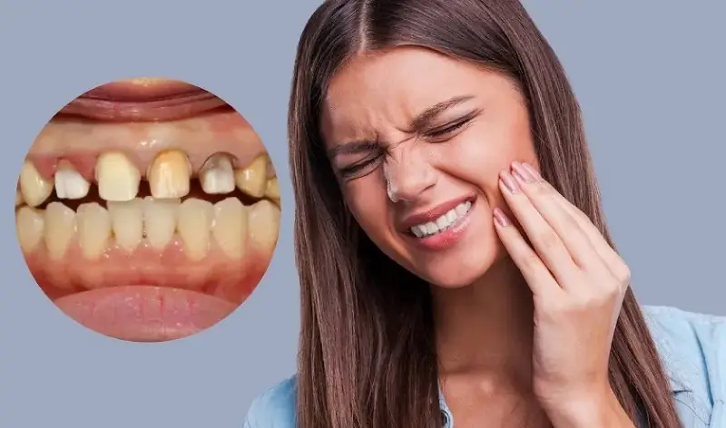 Những người mắc bệnh viêm nhiễm răng miệng thì chưa nên trồng Implant