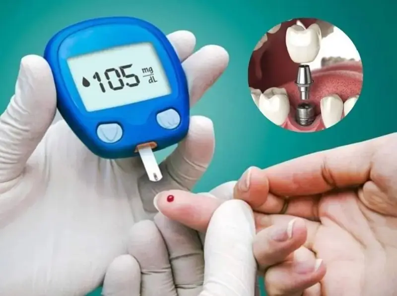 Bệnh tiểu đường kiểm soát tốt có thể trồng Implant