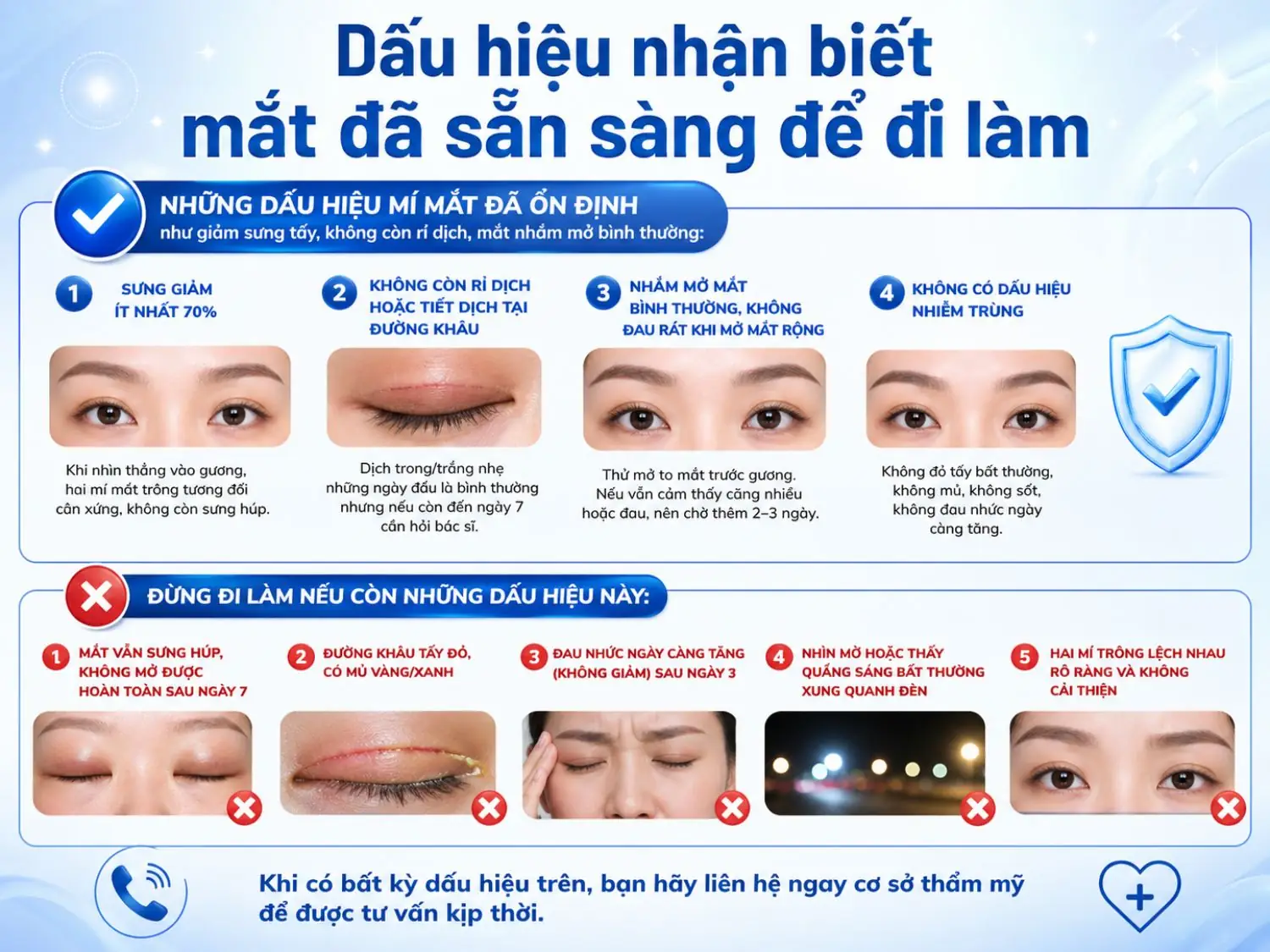 Nhận biết thời điểm mắt ổn định sau cắt mí để quay lại công việc an toàn – tránh biến chứng và đảm bảo kết quả thẩm mỹ tối ưu