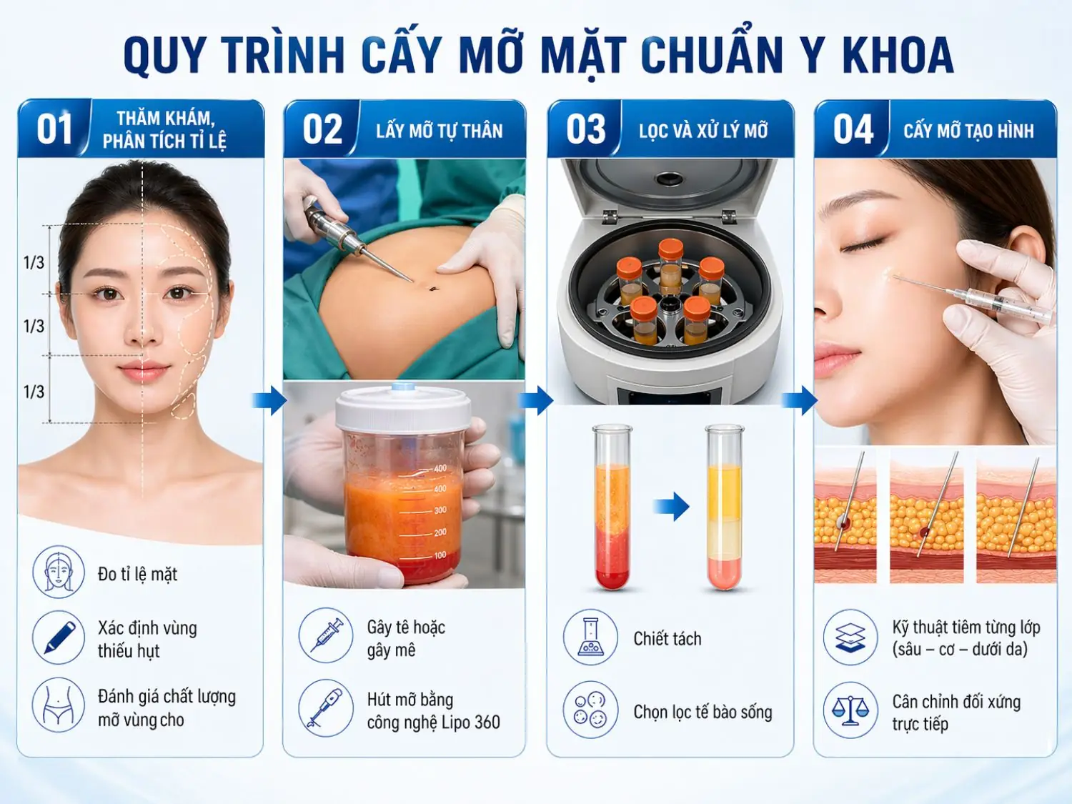 Quy trình cấy mỡ mặt chuẩn y khoa gồm 4 bước chính, giúp tối ưu độ an toàn, tỷ lệ mỡ sống và sự cân đối tự nhiên của khuôn mặt.