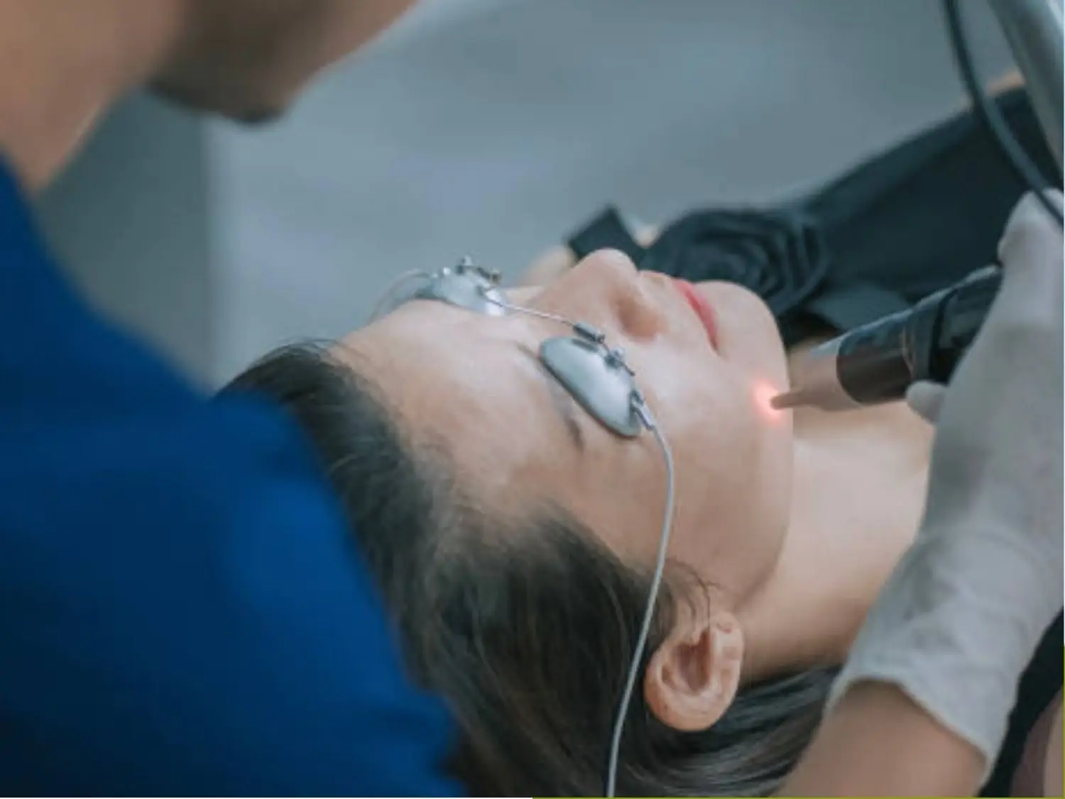 Điều trị nám, tàn nhang và thâm sạm bằng laser picosure pro