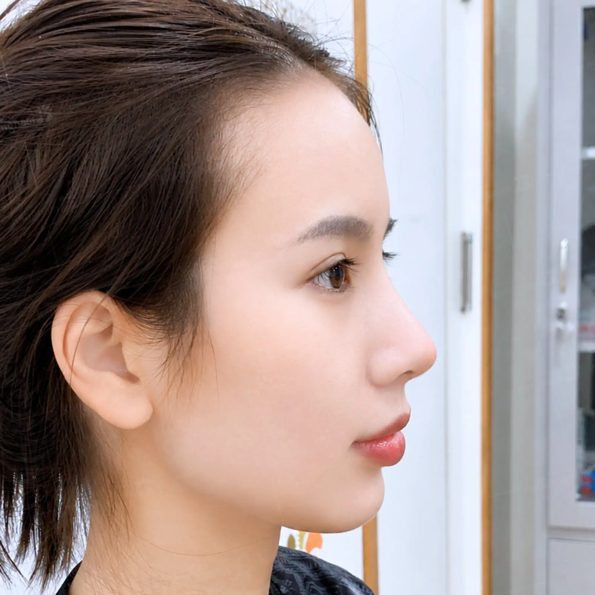 dáng mũi thon gọn, tự nhiên, không cần can thiệp quá nhiều