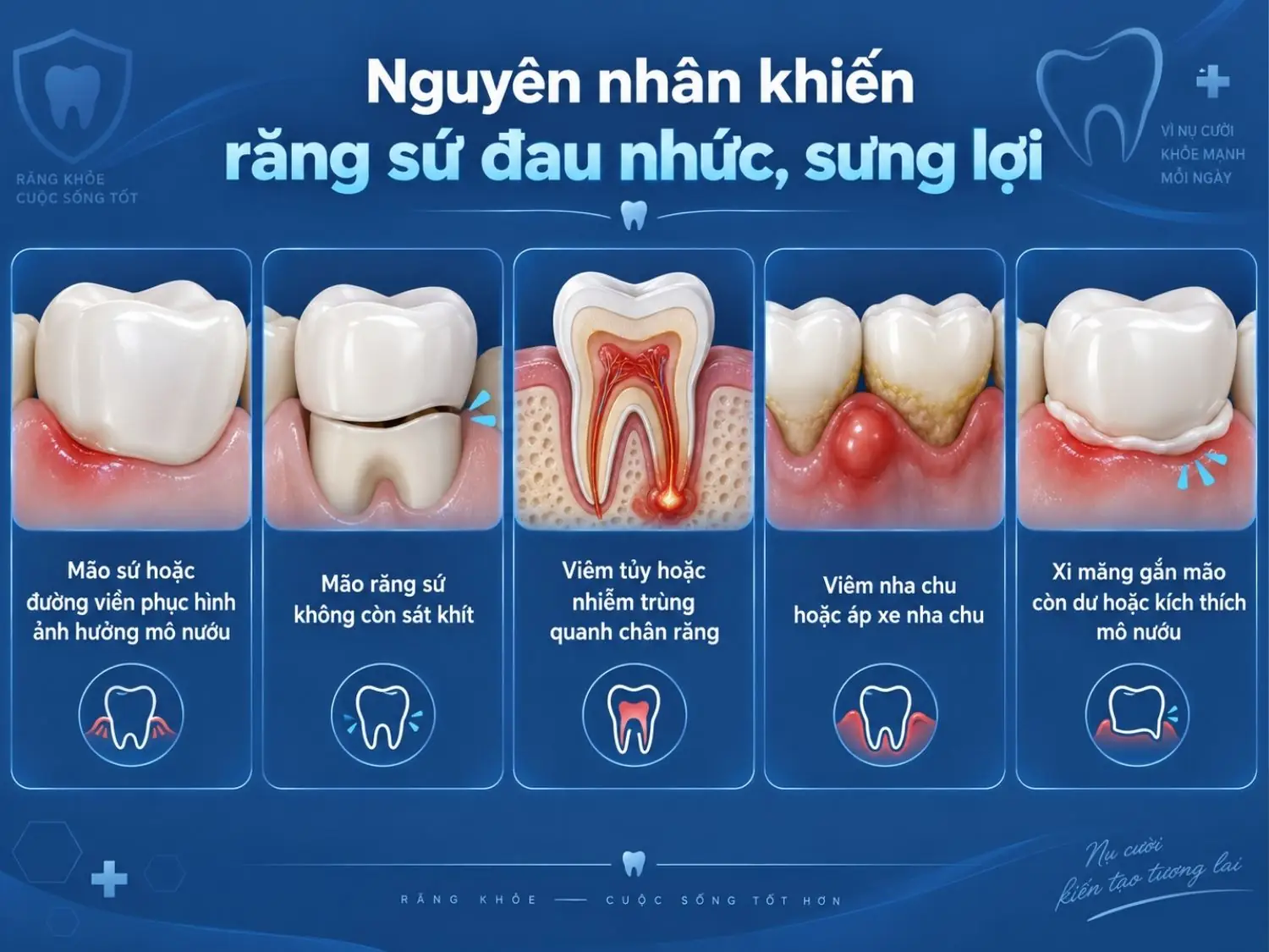 Nguyên nhân khiến răng sứ đau nhức, sưng lợi sau khi làm Mão sứ hoặc đường viền phục hình ảnh hưởng mô nướu, mão răng không khít