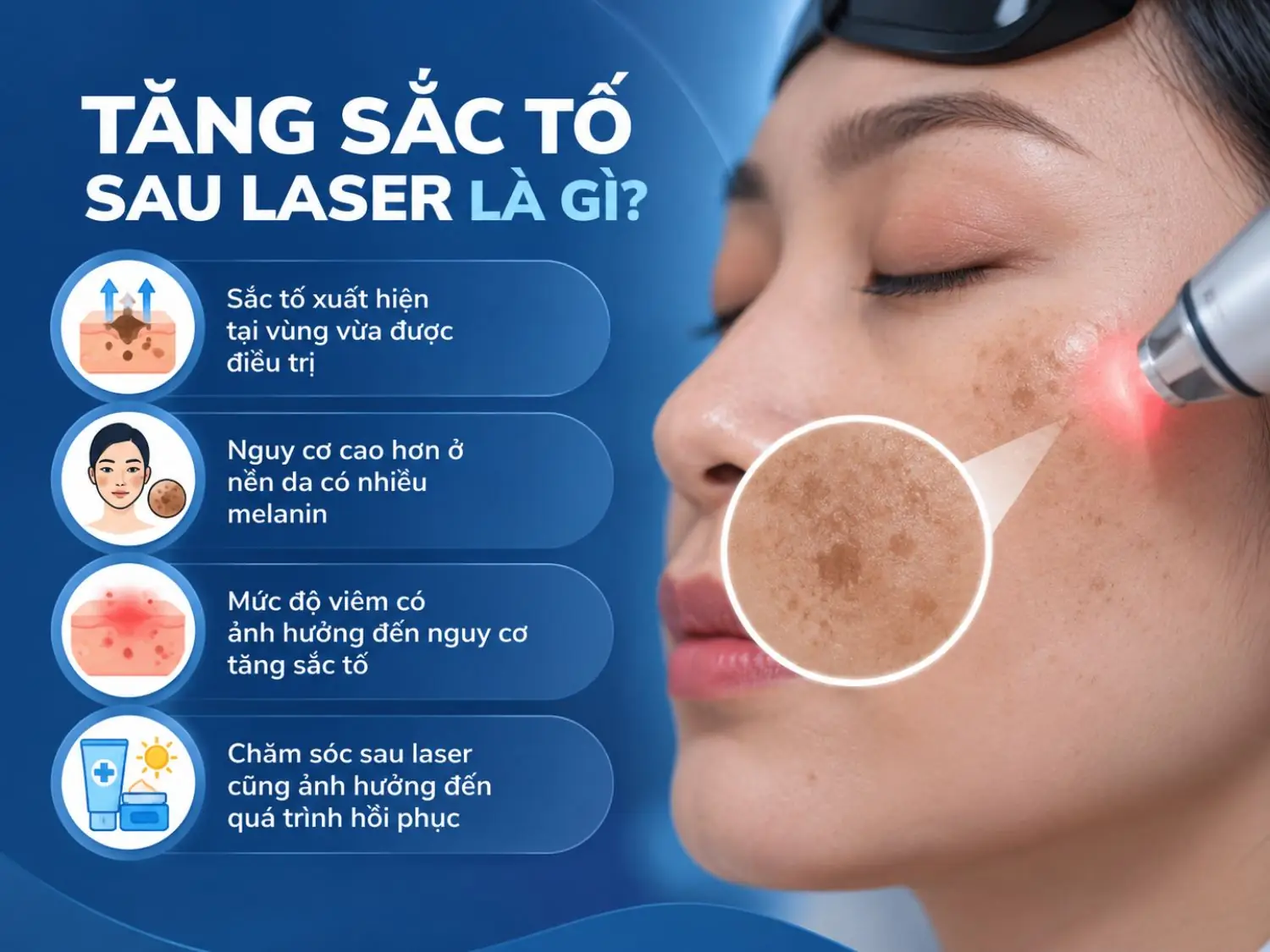 Tăng sắc tố sau laser có thể xuất hiện tại vùng da điều trị, đặc biệt ở nền da nhiều melanin hoặc khi phản ứng viêm mạnh. Chăm sóc và chống nắng đúng cách sau laser cũng đóng vai trò quan trọng trong quá trình phục hồi da.