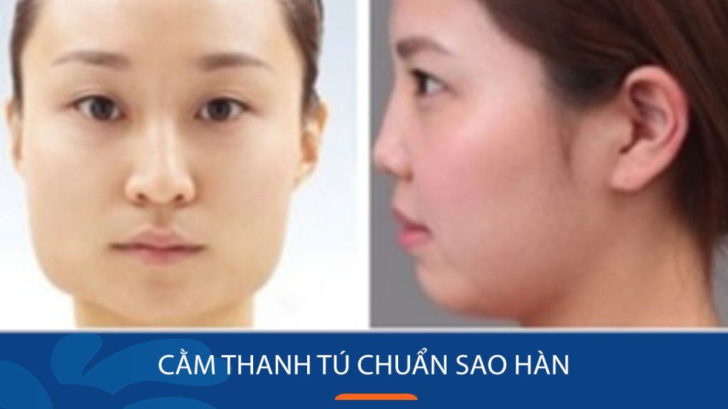 Gọt cằm là gì? Ưu nhược điểm, chi phí, rủi ro và chăm sóc sau phẫu thuật